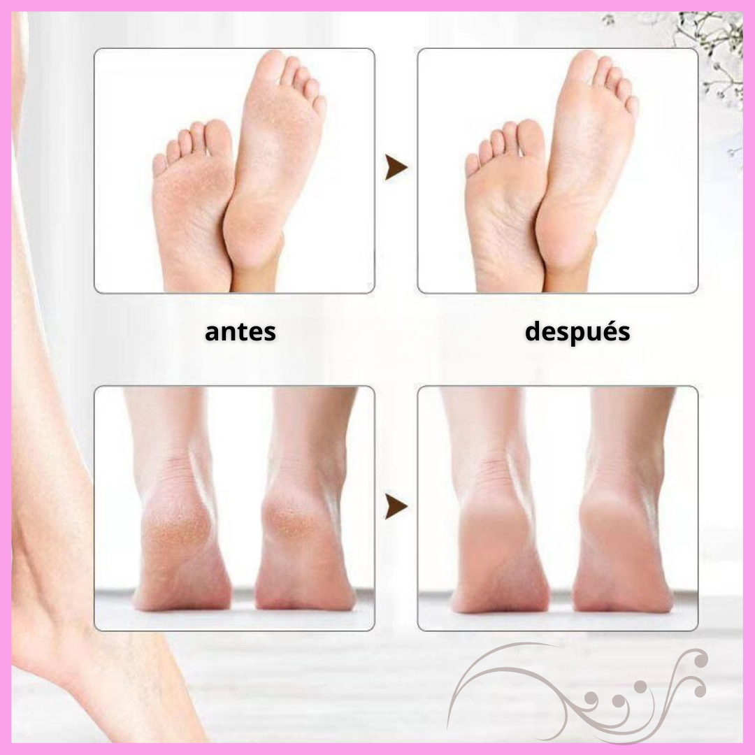 Lima Eléctrica para Pies Resecos Conexión USB con 2 velocidades - Rodillos de Repuesto y Luz LED