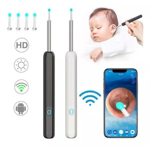 OTOSCOPIO DIGITAL CON CONEXIÓN WIFI